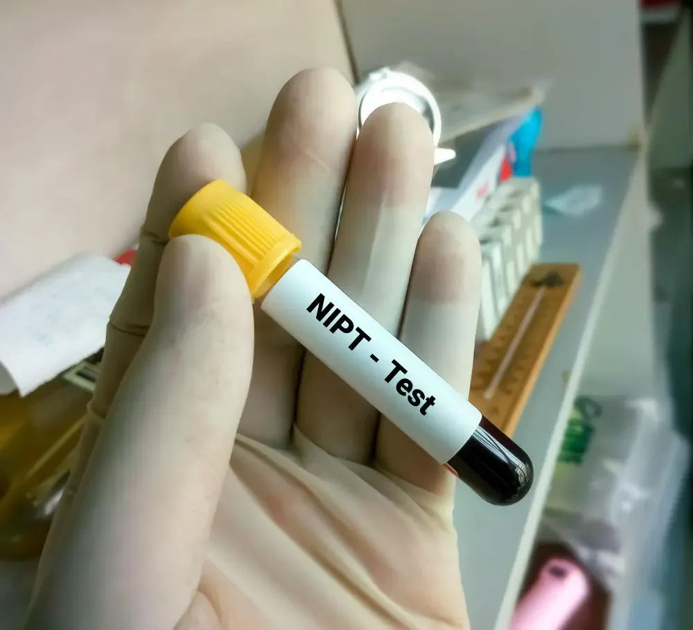 ตรวจโคโมโซมคนท้อง